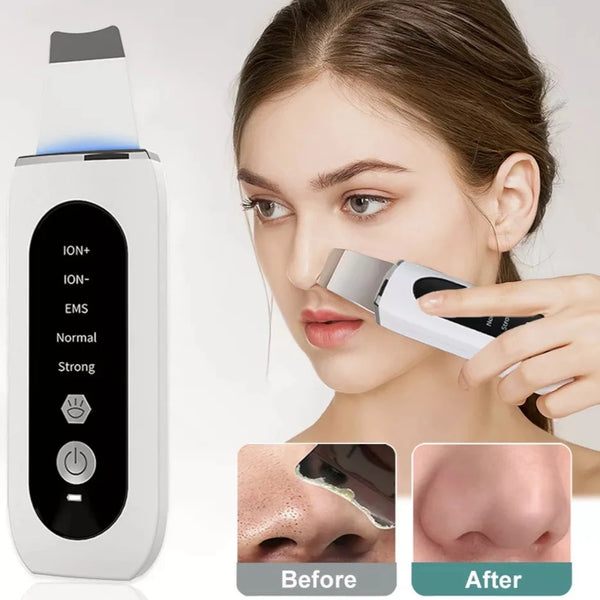 Ultrasonic Skin Scrubber Peeling