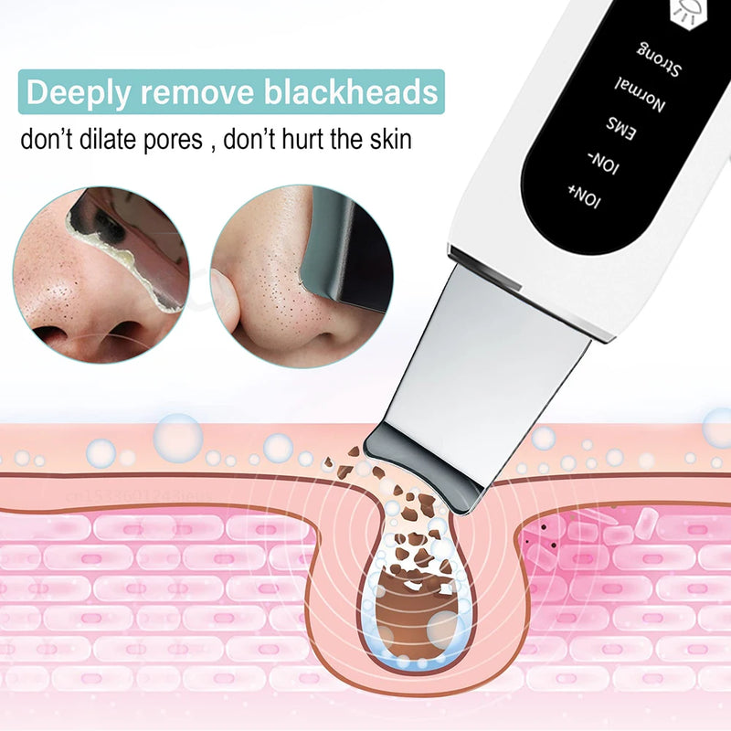 Ultrasonic Skin Scrubber Peeling